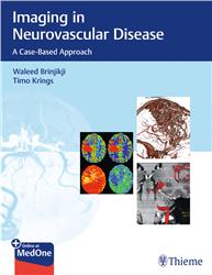 Cover Imaging in Neurovascular Disease