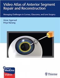 Cover Video Atlas of Anterior Segment Repair and Reconstruction: