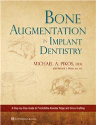 Cover Bone Augmentation in Implant Dentistry