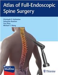 Cover Atlas of Full-Endoscopic Spine Surgery