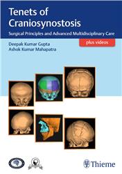 Cover Tenets of Craniosynostosis