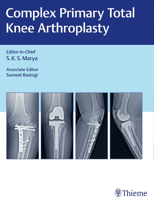 Complex Primary Total Knee Arthroplasty