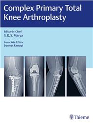 Cover Complex Primary Total Knee Arthroplasty