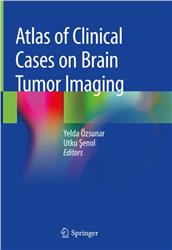 Cover Atlas of Clinical Cases on Brain Tumor Imaging