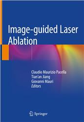 Cover Image-guided Laser Ablation