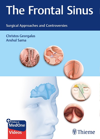 Frontal Sinus Surgery