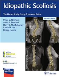 Cover Idiopathic Scoliosis