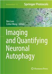 Cover Imaging and Quantifying Neuronal Autophagy