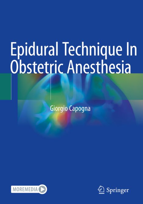 Epidural Technique In Obstetric Anesthesia