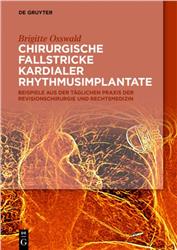 Cover Chirurgische Fallstricke kardialer Rhythmusimplantate