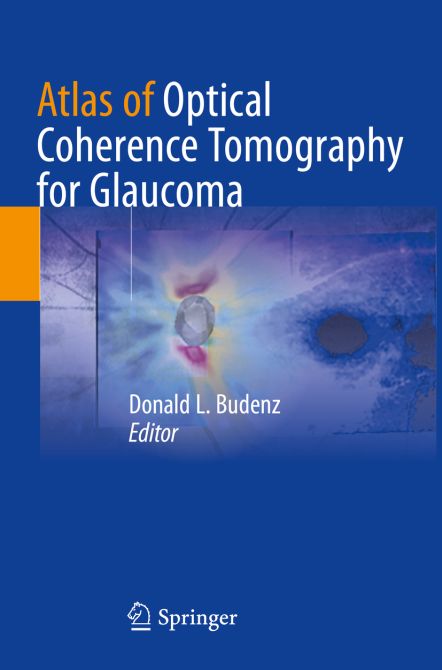 Atlas of Optical Coherence Tomography for Glaucoma