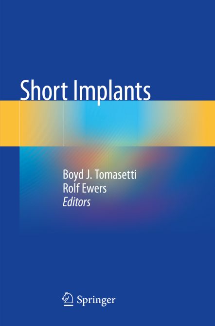 Short Implants