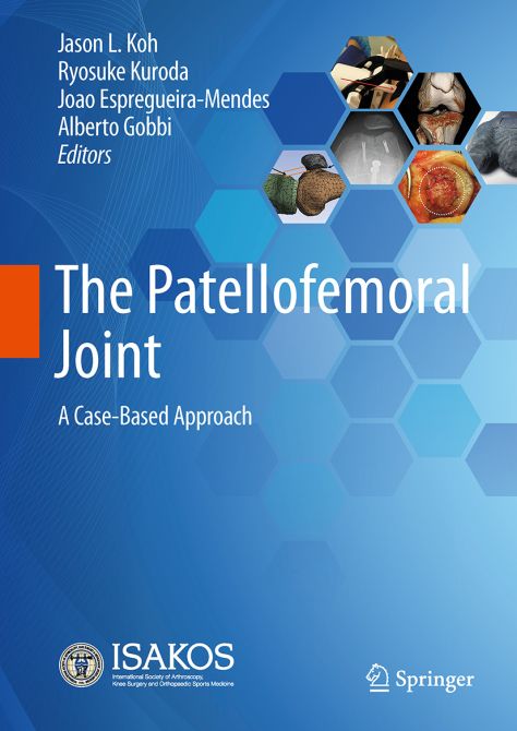 The Patellofemoral Joint