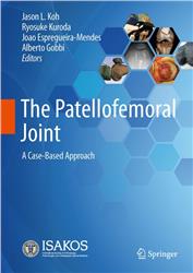 Cover The Patellofemoral Joint