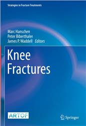 Cover Knee Fractures