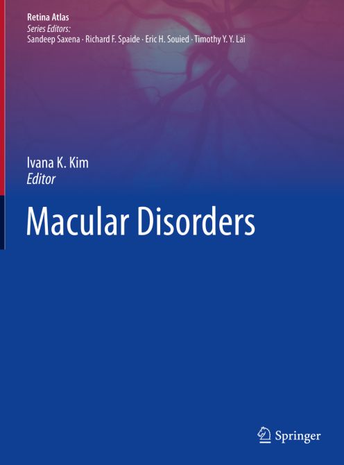 Macular Disorders