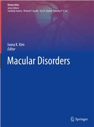 Cover Macular Disorders