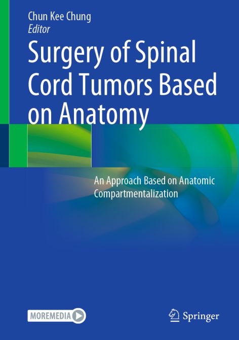 Surgery of Spinal Cord Tumors Based on Anatomy