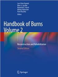 Cover Handbook of Burns Volume 2