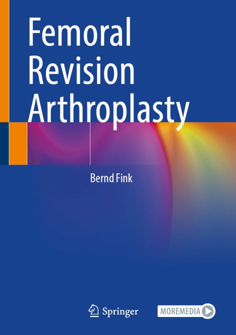 Femoral Revision Arthroplasty