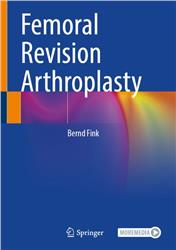 Cover Femoral Revision Arthroplasty