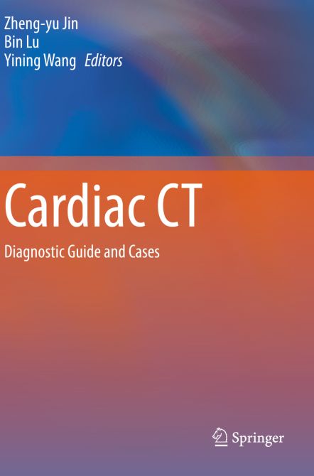 Cardiac CT