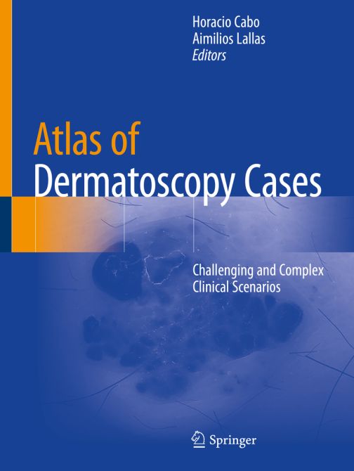 Atlas of Dermatoscopy Cases