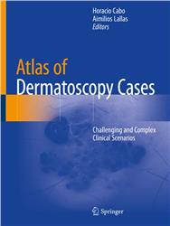 Cover Atlas of Dermatoscopy Cases