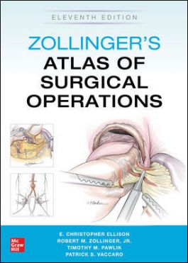 Zollingers Atlas of Surgical Operations