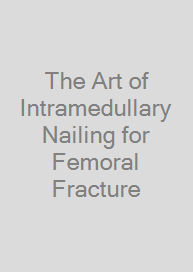 The Art of Intramedullary Nailing for Femoral Fracture