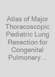 Atlas of Major Thoracoscopic Pediatric Lung Resection for Congenital Pulmonary Airway Malformation