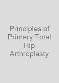Principles of Primary Total Hip Arthroplasty