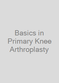 Basics in Primary Knee Arthroplasty