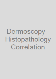 Cover Dermoscopy - Histopathology Correlation