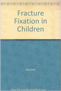 Fracture Fixation in Children