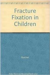 Cover Fracture Fixation in Children