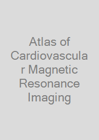 Atlas of Cardiovascular Magnetic Resonance Imaging