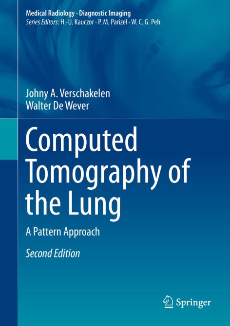 Computed Tomography of the Lung