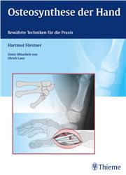 Cover Osteosynthese der Hand
