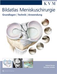 Cover Bildatlas Meniskuschirurgie