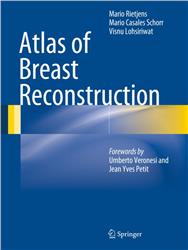 Cover Atlas of Breast Reconstruction