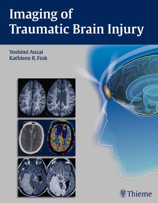 Imaging of Traumatic Brain Injury