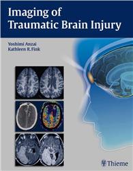 Cover Imaging of Traumatic Brain Injury