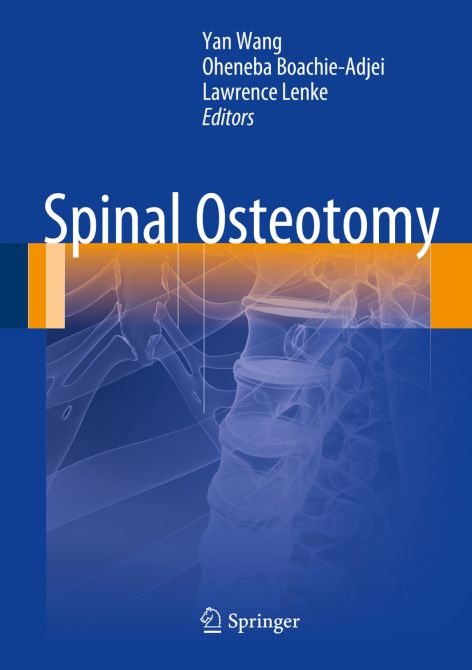 Spinal Osteotomy