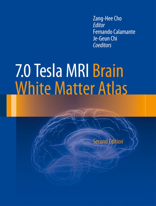 7.0 Tesla MRI Brain White Matter Atlas