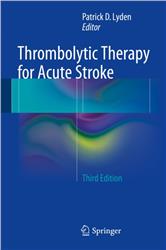 Cover Thrombolytic Therapy for Acute Stroke