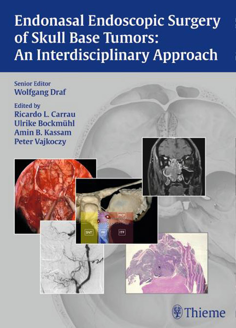 Endonasal Endoscopic Surgery of Skull Base Tumors