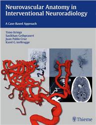 Cover Neurovascular Anatomy in Interventional Neuroradiology