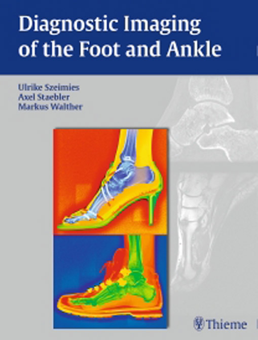 Diagnostic Imaging of the Foot and Ankle