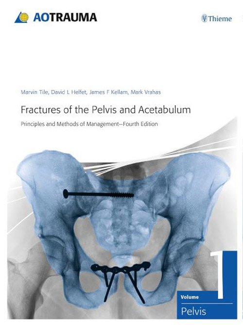 Fractures of the Pelvis and Acetabulum / AO Trauma